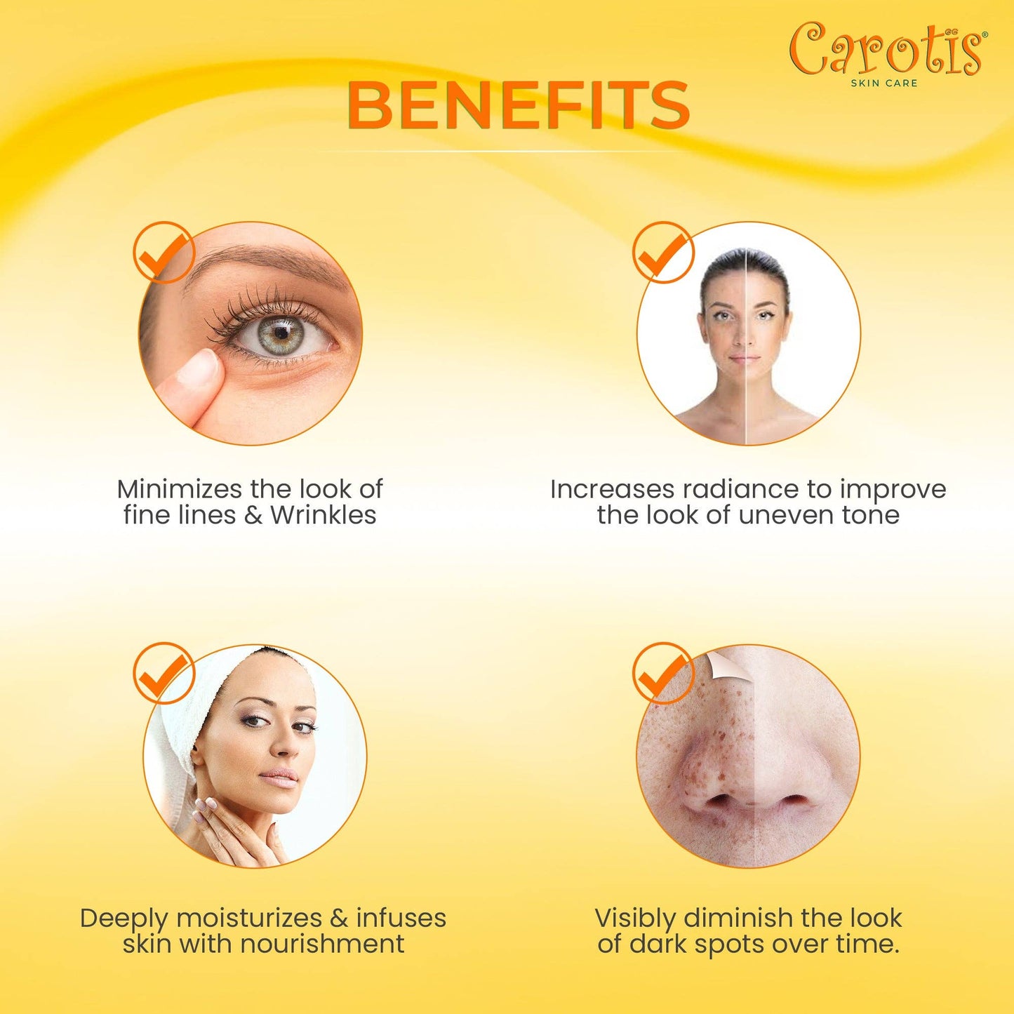 Carotis 7 DAYS Lightening Cream 30gr (With Vitamin "A")